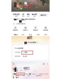3497--北京-周生辰 演员网红硬W 170天然E